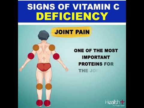 Signs of Vitamin C Deficiency
