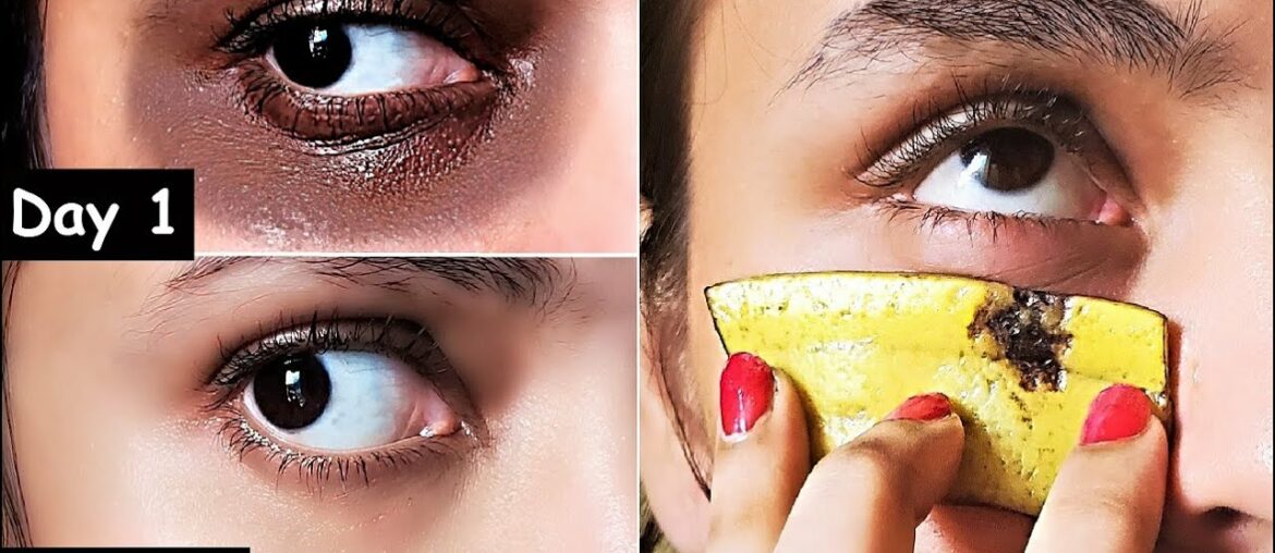 i Removed DARK CIRCLES in 15 Days with Banana Peel Eye Pack | Remove Eye Wrinkles & Under Eye bags