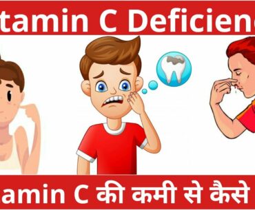 Vitamin C Foods | Benefits | Deficiency and its Prevention (Hindi)