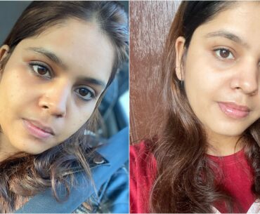 How I got clear and glowing skin | Best Vitamin C serum | Klairs Vitamin C Serum Review