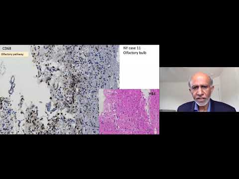 Science of COVID-19: "Neurological Complications of Coronaviruses"