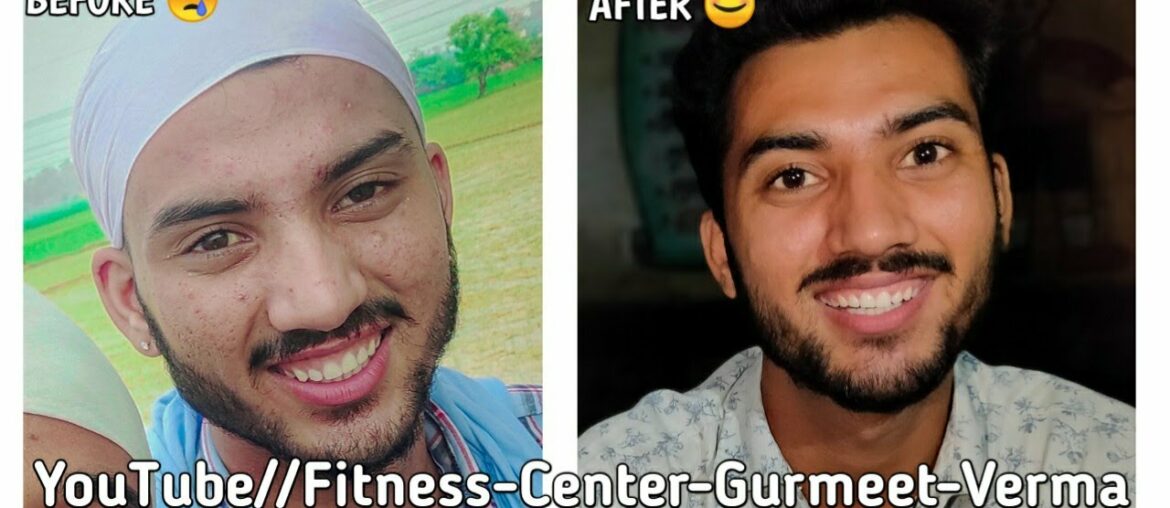 hn skin booster || Herbalife Nutrition || Skin Products Results || Skin Care || skin pimples product