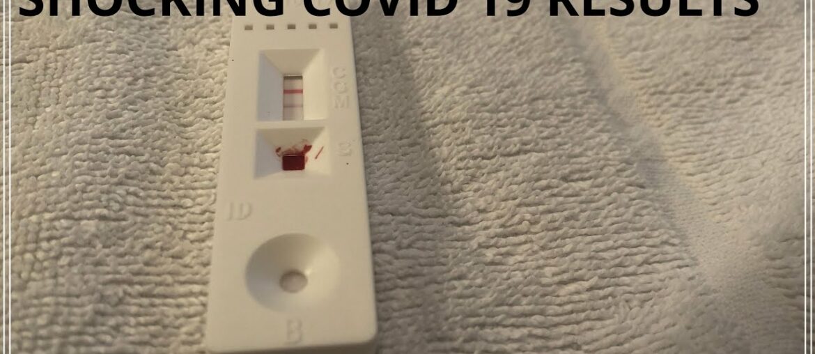 COVID 19-RAPID TEST ANTI BODY TEST AND HOW TO USE AT HOME-SHOCKING RESULTS #CORONA VIRUS
