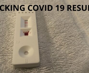COVID 19-RAPID TEST ANTI BODY TEST AND HOW TO USE AT HOME-SHOCKING RESULTS #CORONA VIRUS