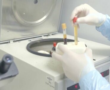 Researchers create lab-grown protein for more accurate COVID-19 antibody test