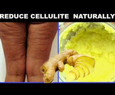 MY AT HOME CELLULITE TREATMENTS | CELLULITE HOME REMEDIES | Khichi Beauty