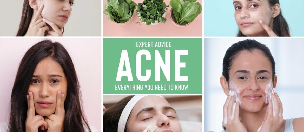 What Is Acne & How To Treat Acne, Acne Scars & Pimples | Expert Advice & Nutrition Tips