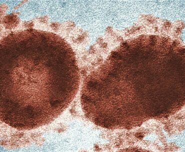 CORONAVIRUS COVID -19,  PT 12.  THE SECOND WAVE