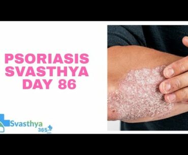 Psoriasis I Day-86