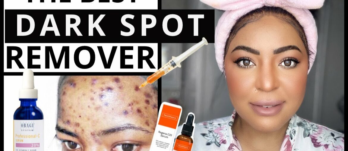 Skincare Game Changer | VITAMIN C For Hyperpigmentation Routine| Dark Spot Remover
