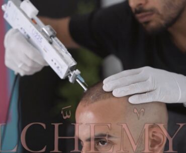 #PRP MIXED #A22 VITAMINS : YOUR MONTHLY “HAIR GYM” TREATMENT