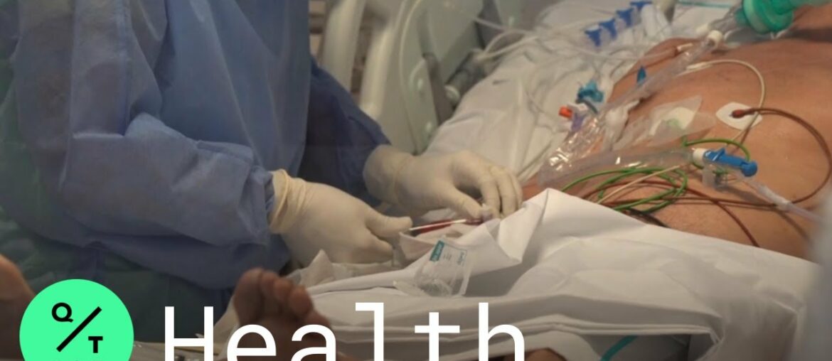 Covid Scientists Find a Turning Point in Life-Threatening Cases