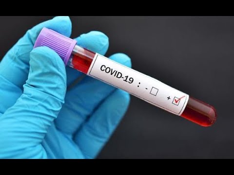UArizona researchers look at how long COVID-19 immunity lasts