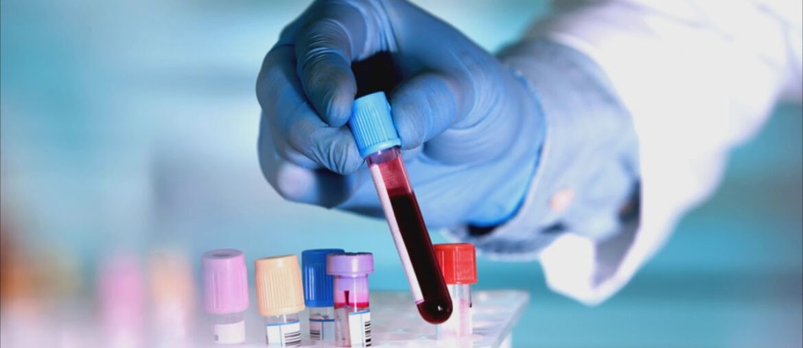 coronavirus vaccine developed by the University of Oxford appears safe and trains the immune system