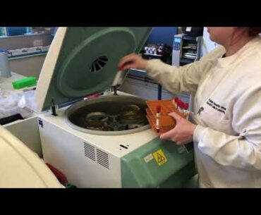 Coronavirus Effect | Vitamin D | Cuts chance of coronavirus death by half