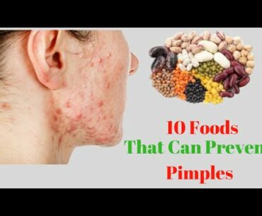 10 Foods That Can Prevent Pimples