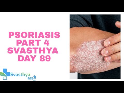 Psoriasis Part 4 I Day-89