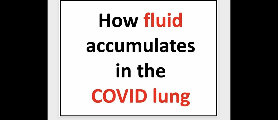 How fluid accumulates in the COVID lung