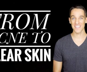 Natural Acne Remedies - The Best Herbs and Supplements for Clear Skin