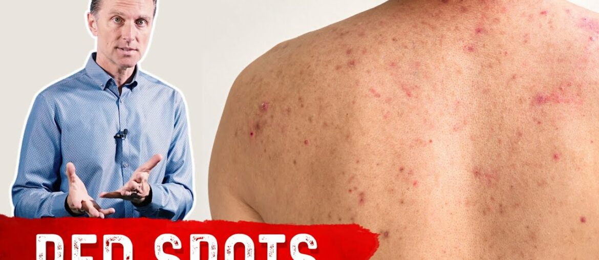 Why Red Spots on My Skin?
