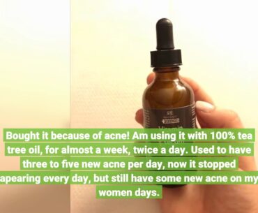 Our New Review: Radha Beauty Glow Boosting Vitamin C Moisturizer, 1.7 fl oz. for Face, Neck, De...