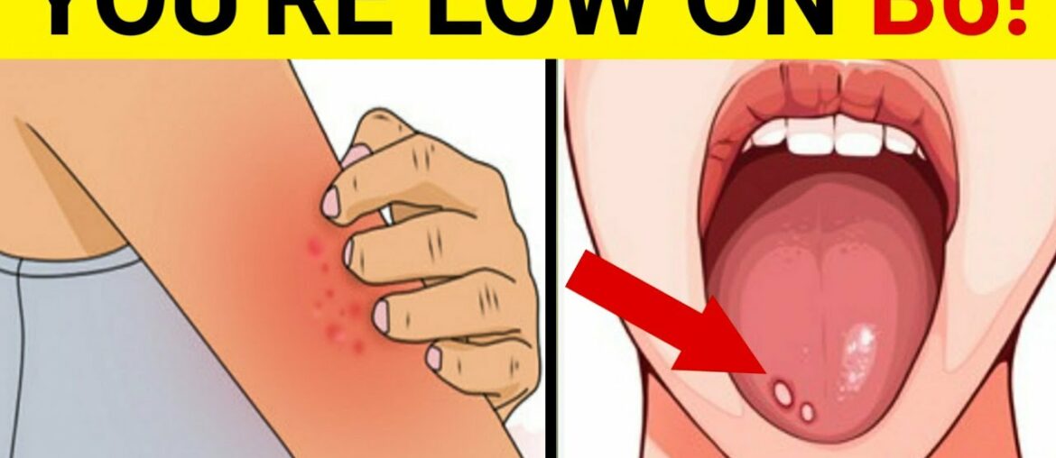 Vitamin B6 : 11 Signs You Have Vitamin B6 Deficiency