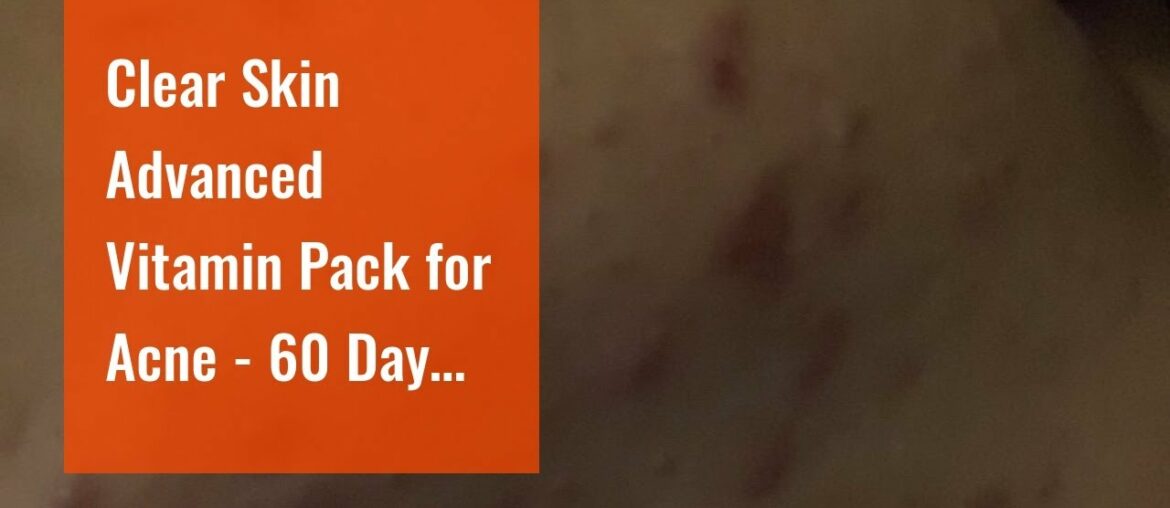 Clear Skin Advanced Vitamin Pack for Acne - 60 Day Supply of Vitamins for Acne