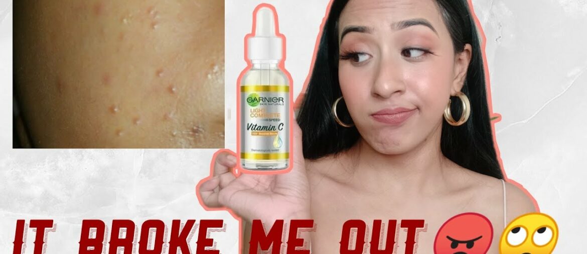 Reduce Dark Spots in 3 days???  Garnier Light Complete Vitamin C Booster Serum Review