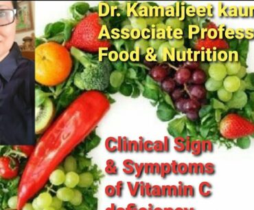 Community Nutrition, B.H.Sc 3: Clinical Sign and Symptoms of Vitamin C Deficiency