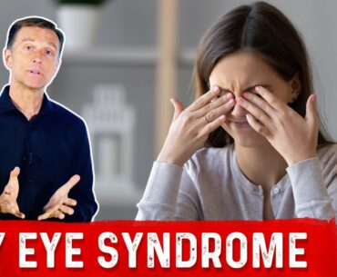 Best Foods for Dry Eyes