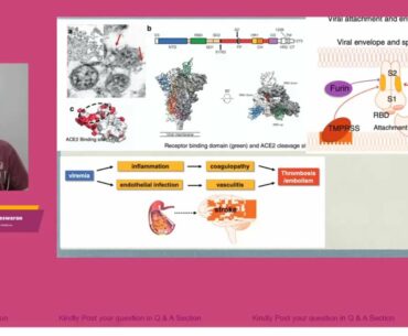 Neurovascular Complications of COVID19 | Dr Sivarajan Thandeswaran, Neurovascular &Stroke Specialist