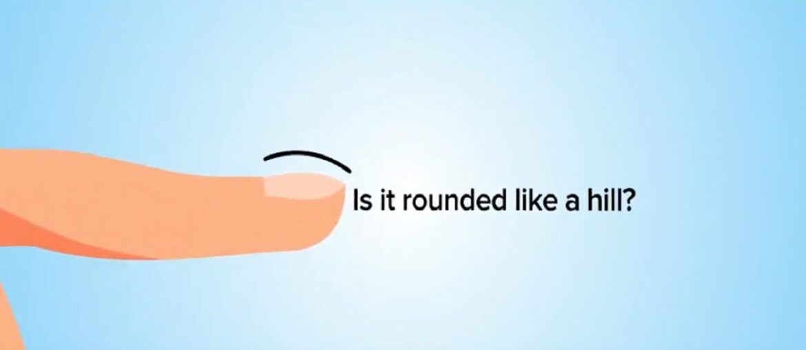 10 Second Fingernail Test Reveals If You’re Running Dangerously LOW On Vitamin C