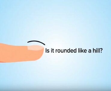 10 Second Fingernail Test Reveals If You’re Running Dangerously LOW On Vitamin C