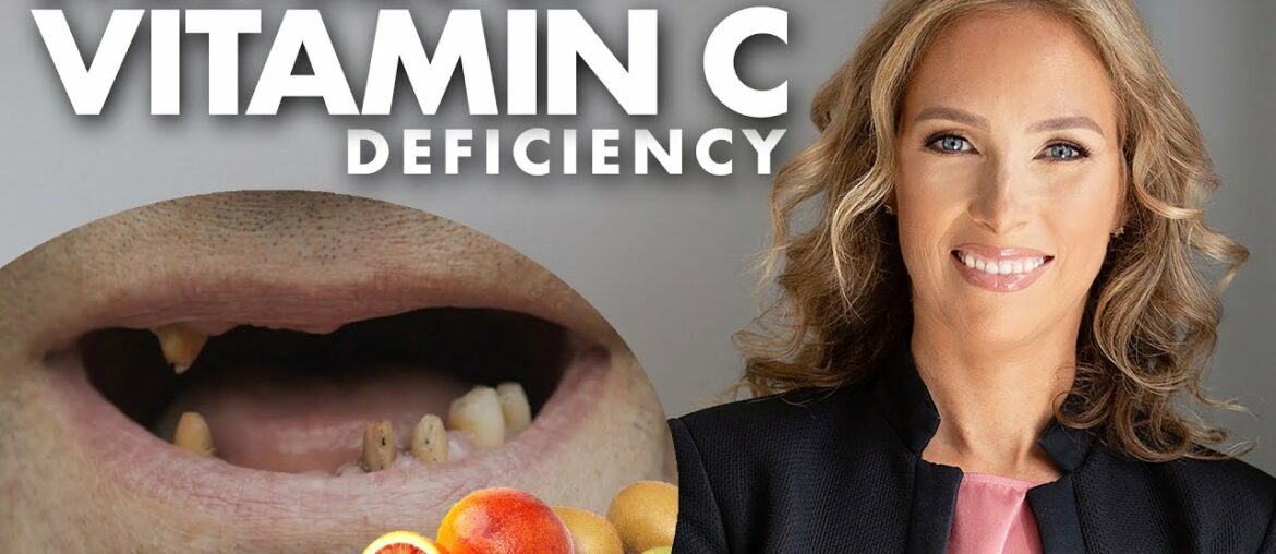 Symptoms Of Vitamin C Deficiency - Dr. J9Live