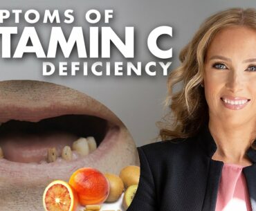 Symptoms Of Vitamin C Deficiency - Dr. J9Live
