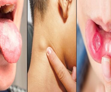 Cheapest Most Important Miracle Vitamin To Repair Tendons & Ligaments Actually Need On A Daily Basis