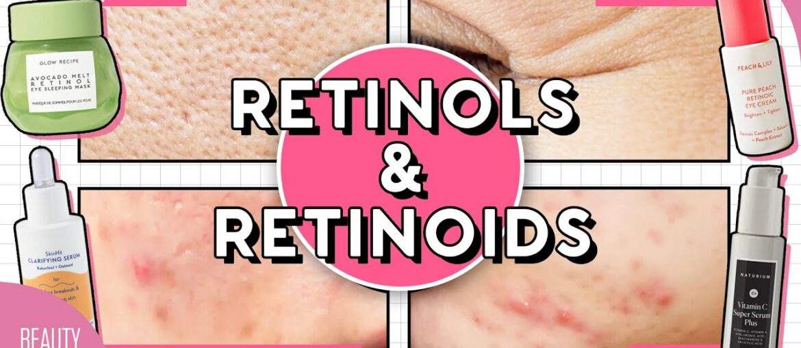 How to Use Vitamin A for Acne, Hyperpigmentation, Large Pores, Fine Lines & More!