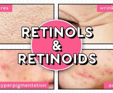 How to Use Vitamin A for Acne, Hyperpigmentation, Large Pores, Fine Lines & More!
