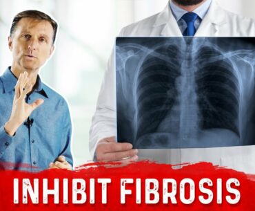 Vitamin E Inhibits Scar Tissue (Fibrosis)