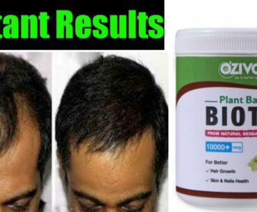 Oziva Plant Based Biotin Review || Best For Hair Growth/Nails/Skin