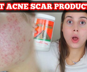 BEST PRODUCTS FOR ACNE SCARS AND SKIN HEALING!!