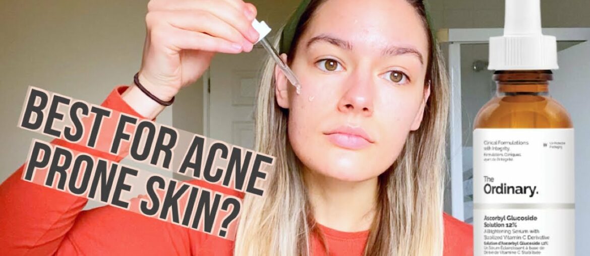 Best Vitamin C serum for Sensitive Acne Prone Skin| The Ordinary Ascorbyl Glucoside 12% review