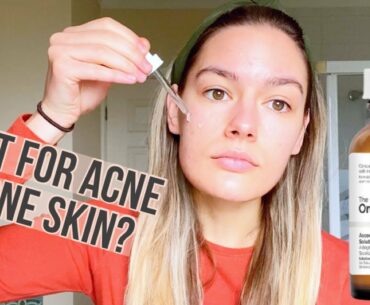 Best Vitamin C serum for Sensitive Acne Prone Skin| The Ordinary Ascorbyl Glucoside 12% review