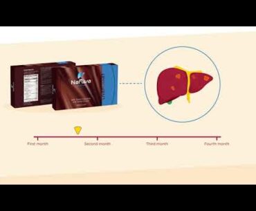 Nafliva Dark Chocolate for Liver Health