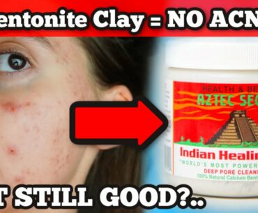 TESTING BENTONITE HEALING CLAY 3 YEARS LATER... HAS MY OPINION CHANGED ABOUT THIS MASK FOR ACNE!?