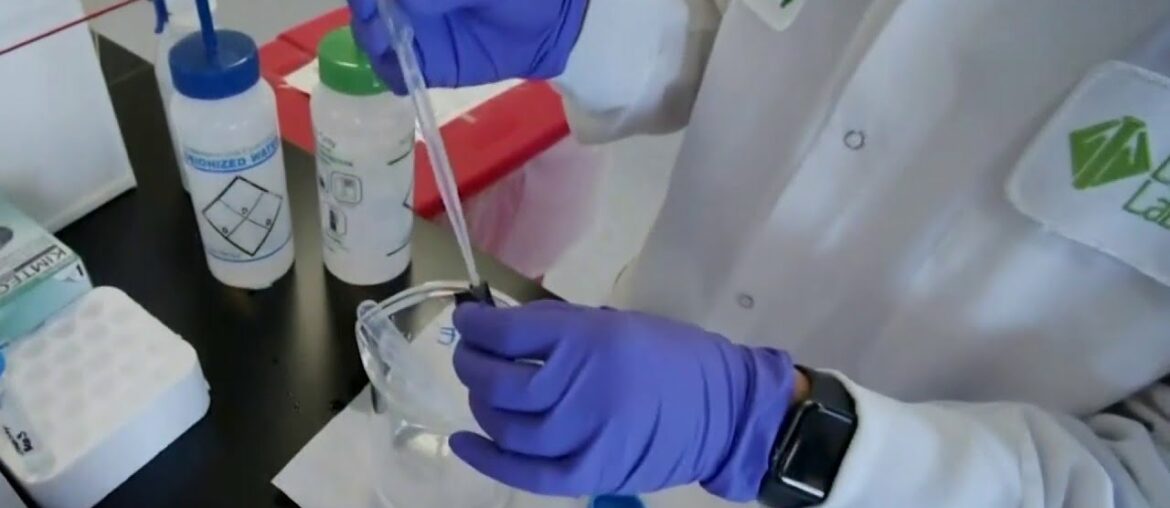 Physicians develop test to predict mild or severe COVID-19 symptoms