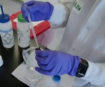 Physicians develop test to predict mild or severe COVID-19 symptoms