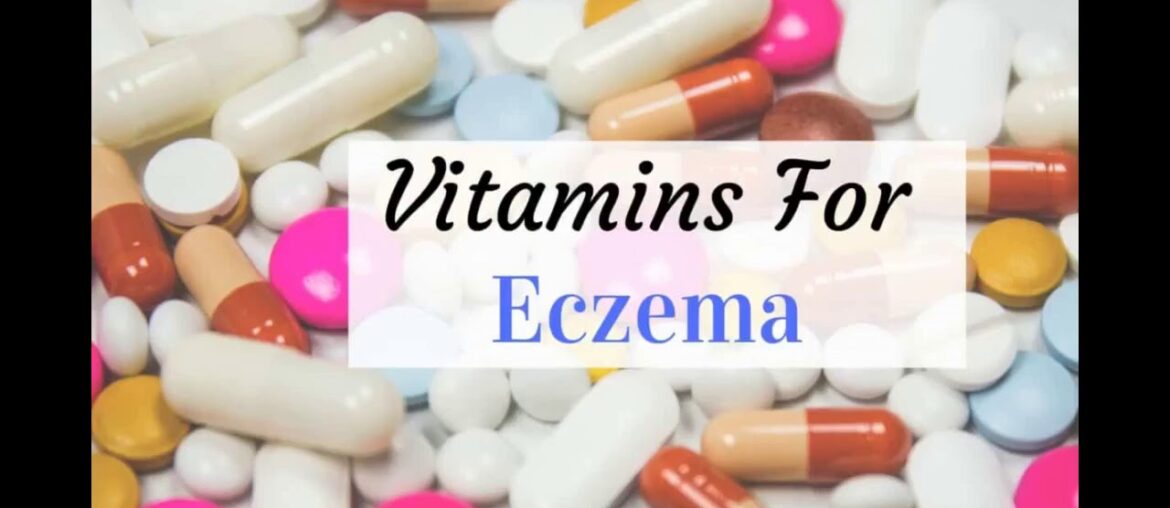 Excitement About Vitamins and Supplements: Herbal, Dietary, and More - Health