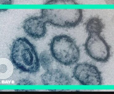 Concern grows over relaxing COVID-19 restrictions after research shows man caught virus twice