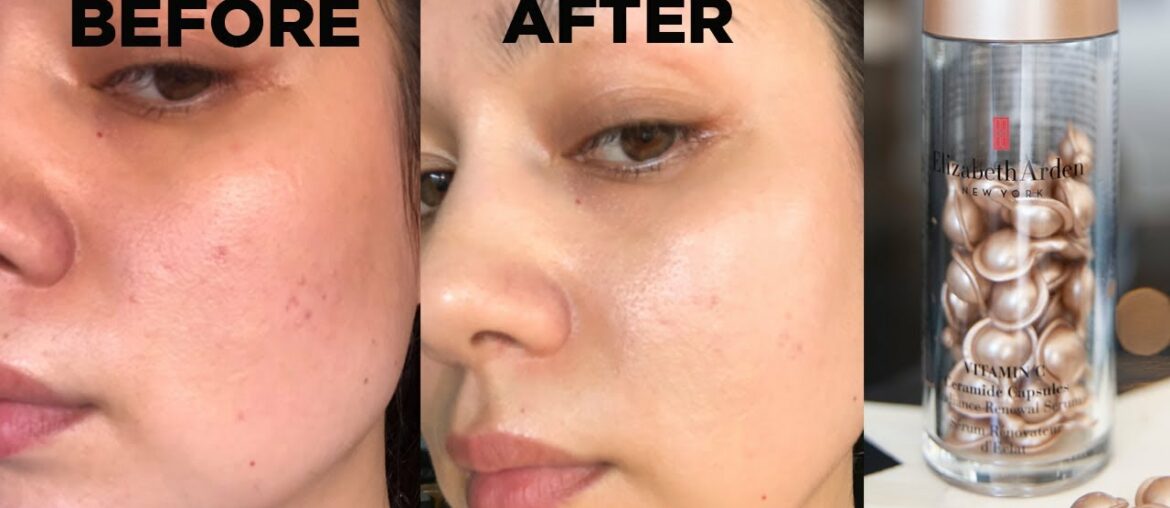 Skincare Game Changer!: Elizabeth Arden Vitamin C Ceramide Capsules